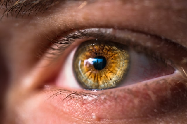 Can lasik correct astigmatism nearsightedness?